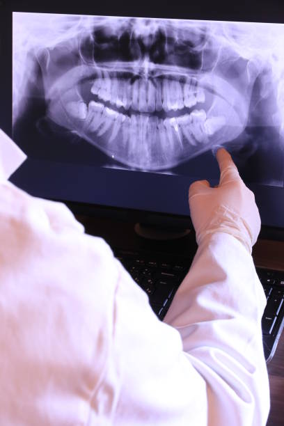 Best Emergency Treatment for Dental Infections or Abscesses in Washburn, IL