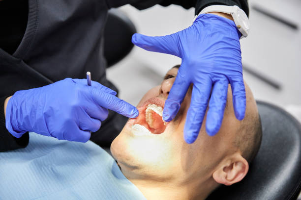 Best Emergency Treatment for Dental Infections or Abscesses in Washburn, IL