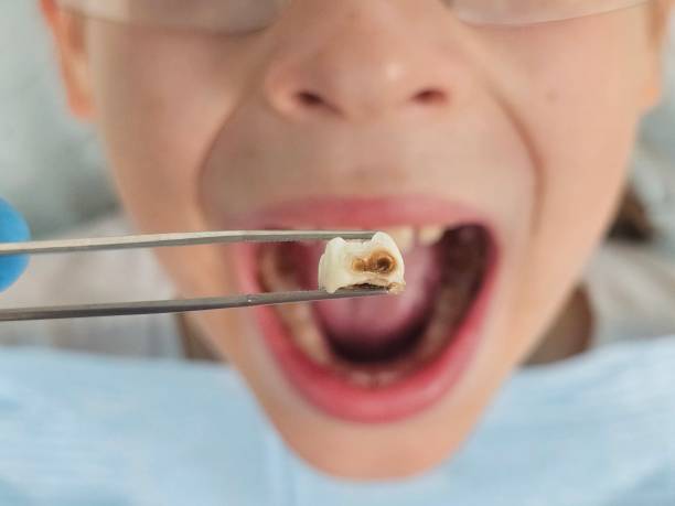  Washburn, IL Emergency Dentist Pros